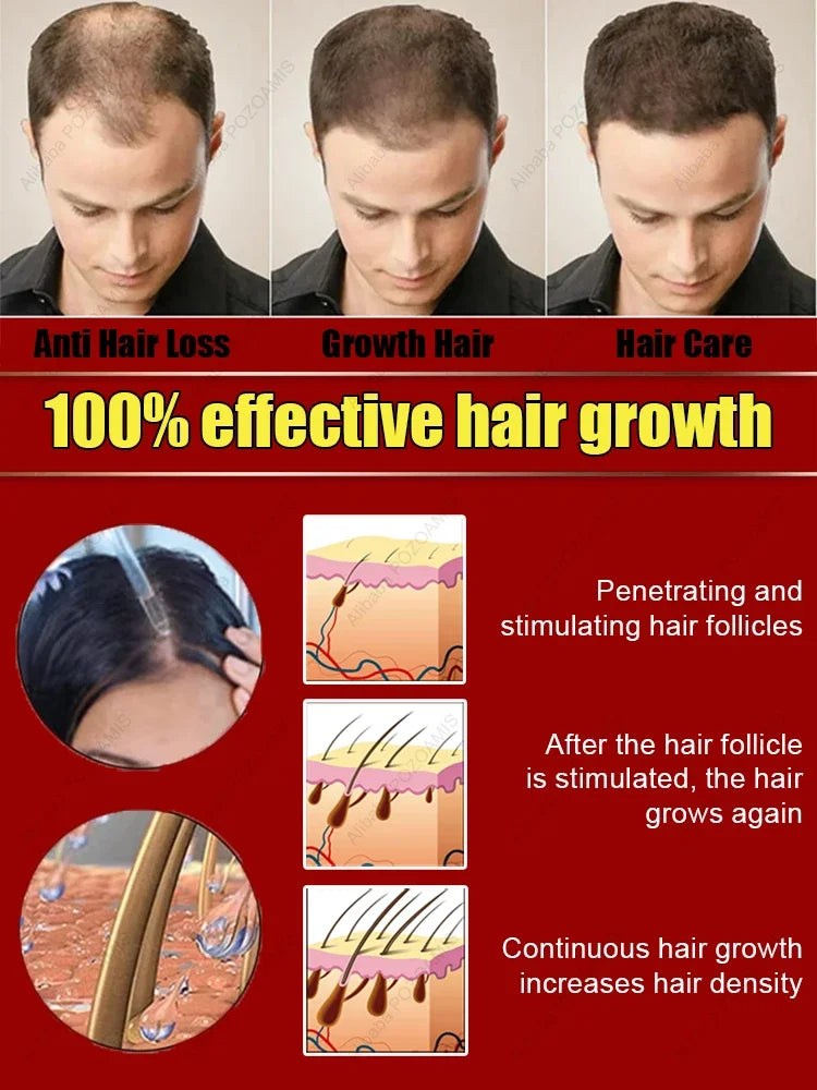 98% of buyers buy again, have more and more hair, say goodbye to baldness, thick hair,Hot selling product